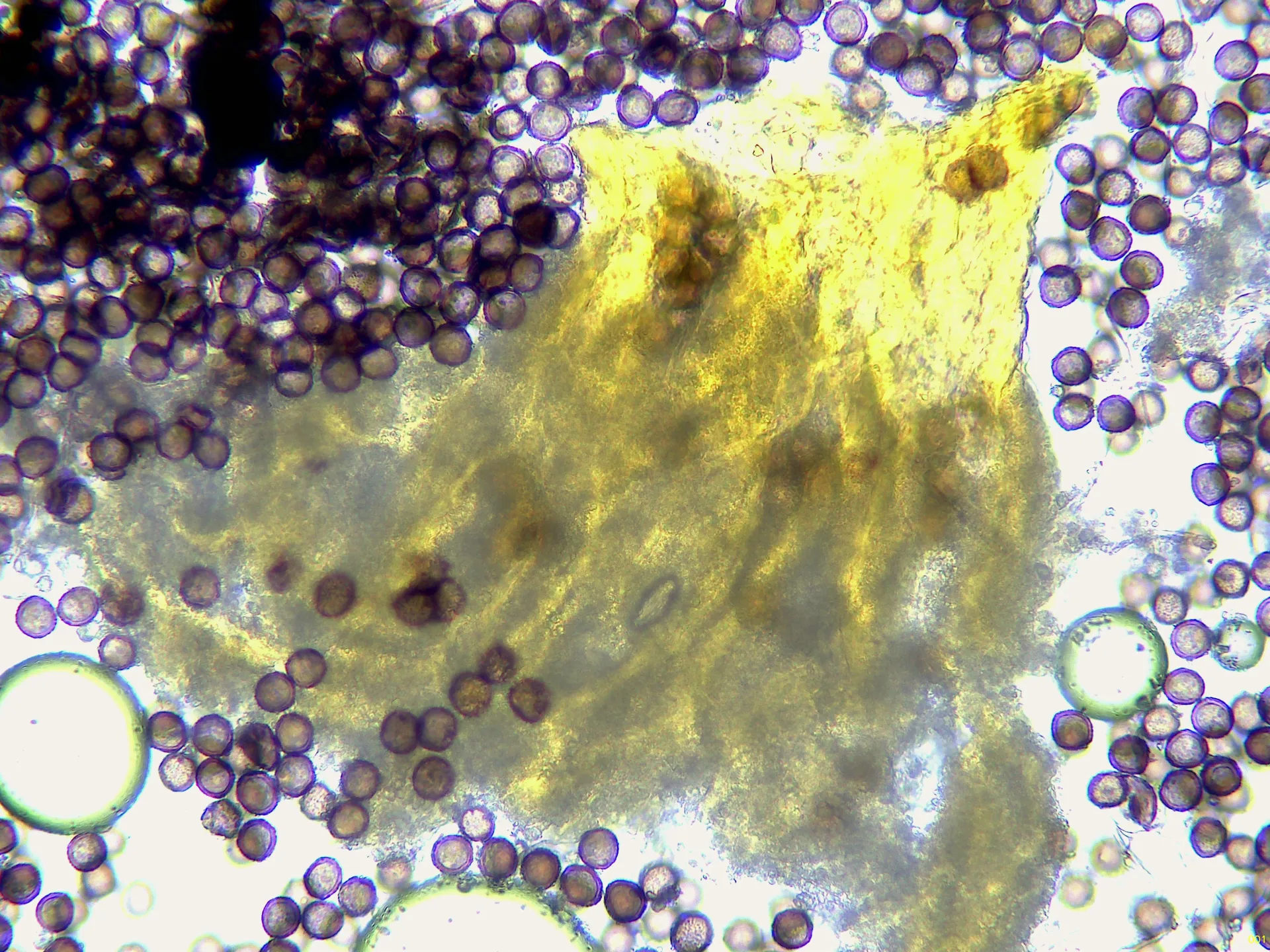 Microscopía de Physarum robustum - 10 - Pie x 400-001